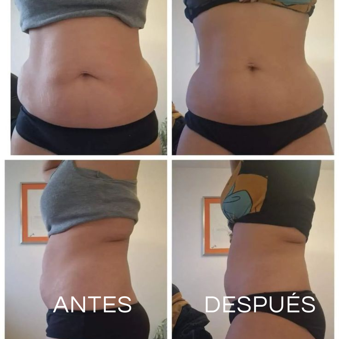 Bloom | Apoyo para intestinos sensibles
